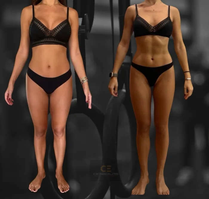Comparativa de Marina antes y después de tres meses, sin mostrar la cara